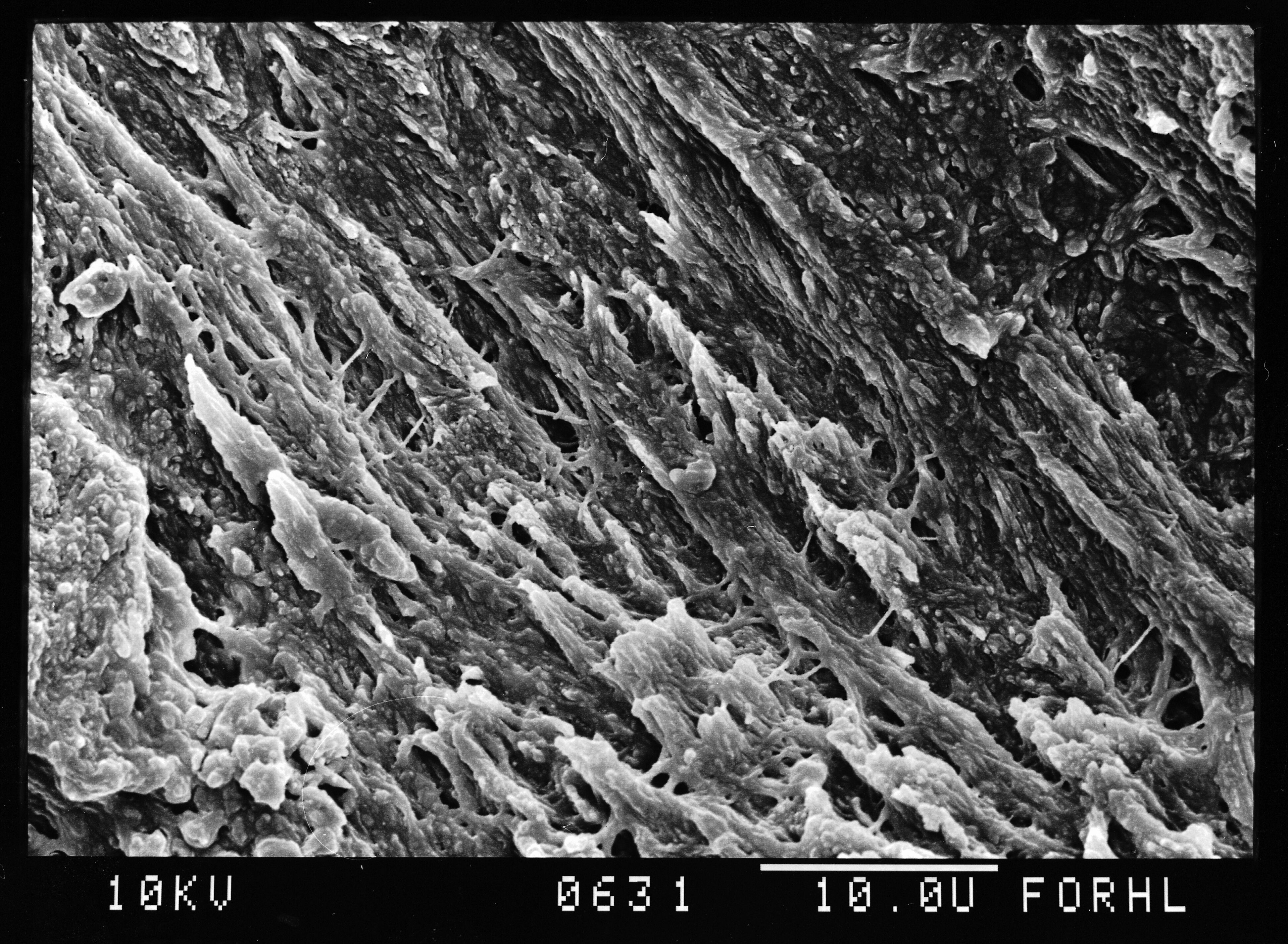 Scanning electron micrograph of the surface of normal bone showing the fibrous collagen matrix ultrastructure