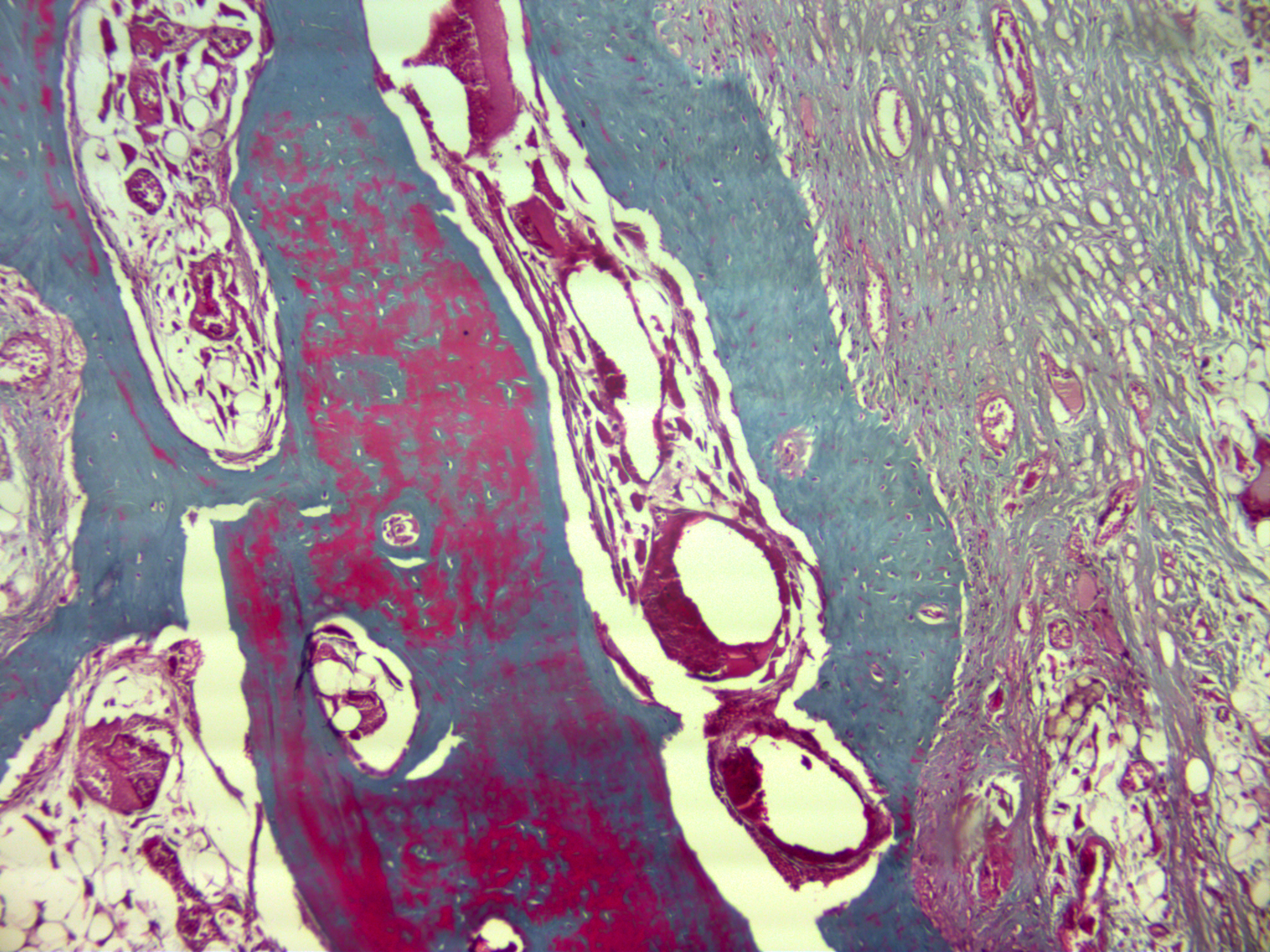 Bone histomorphometry image showing bone tissue with osteoid seams and mineralized matrix used to measure the remodeling cycle