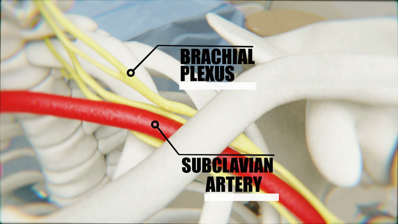 Three-dimensional medical illustration of the brachial plexus crossing behind the clavicle with the roots, trunks, and cords that feed every upper limb compartment nerve