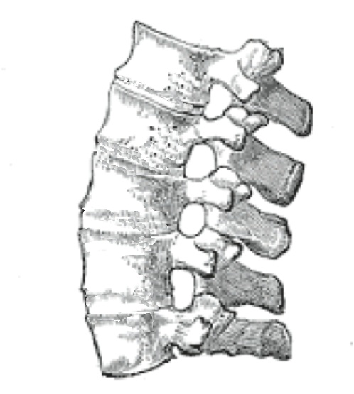 Anatomical line drawing of a lateral spinal segment showing thin bony bridges (syndesmophytes) spanning the anterior vertebral bodies