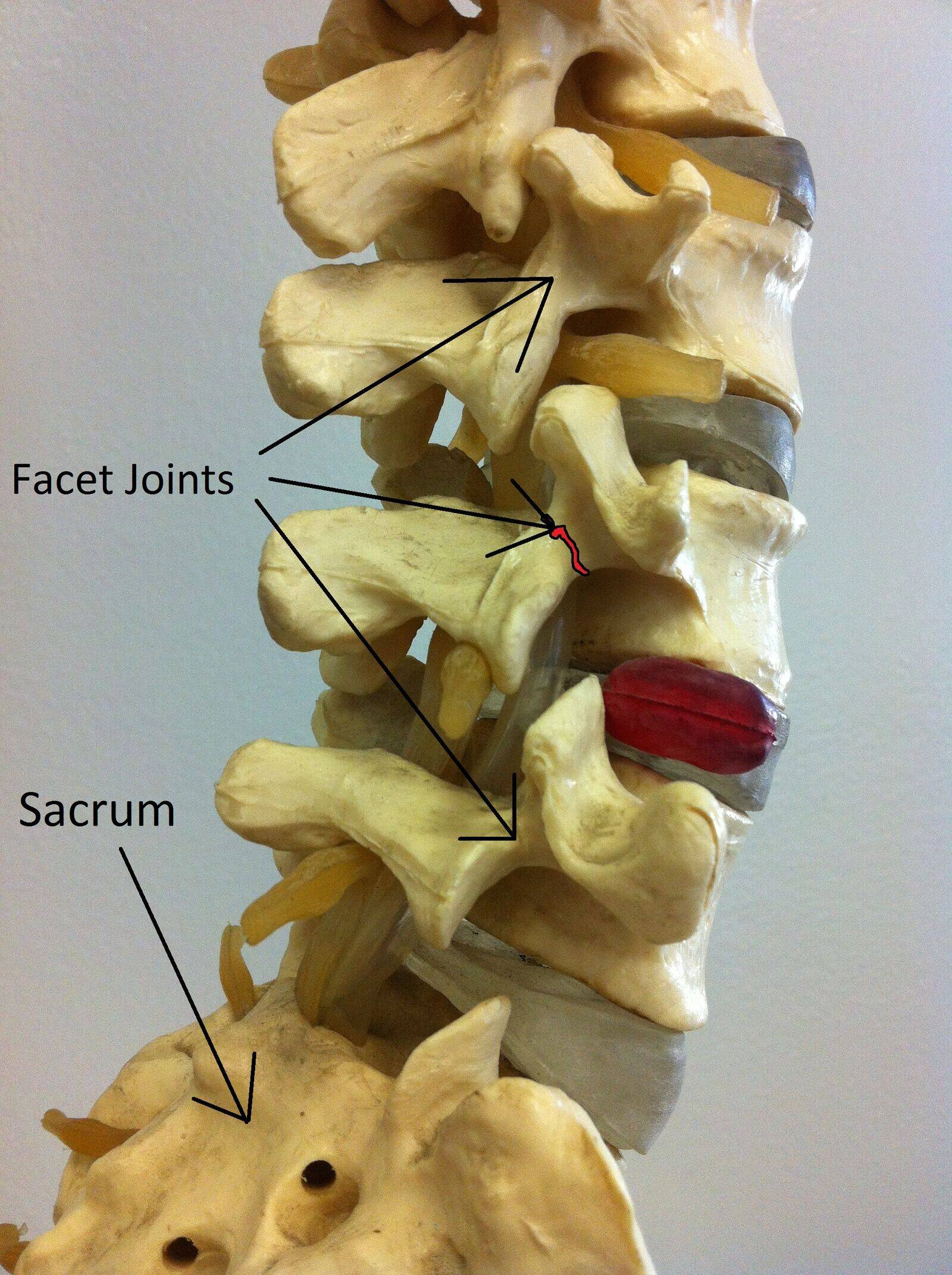 Anatomical model of the lumbar spine showing the pars interarticularis, the Scottie dog collar