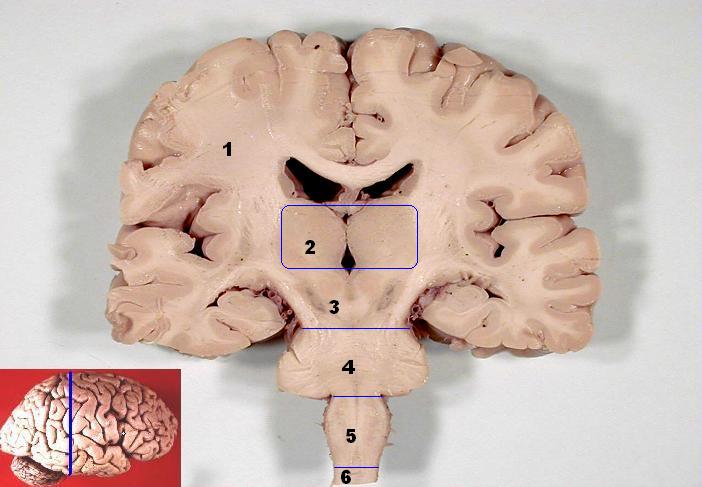 Coronal section showing thalamus