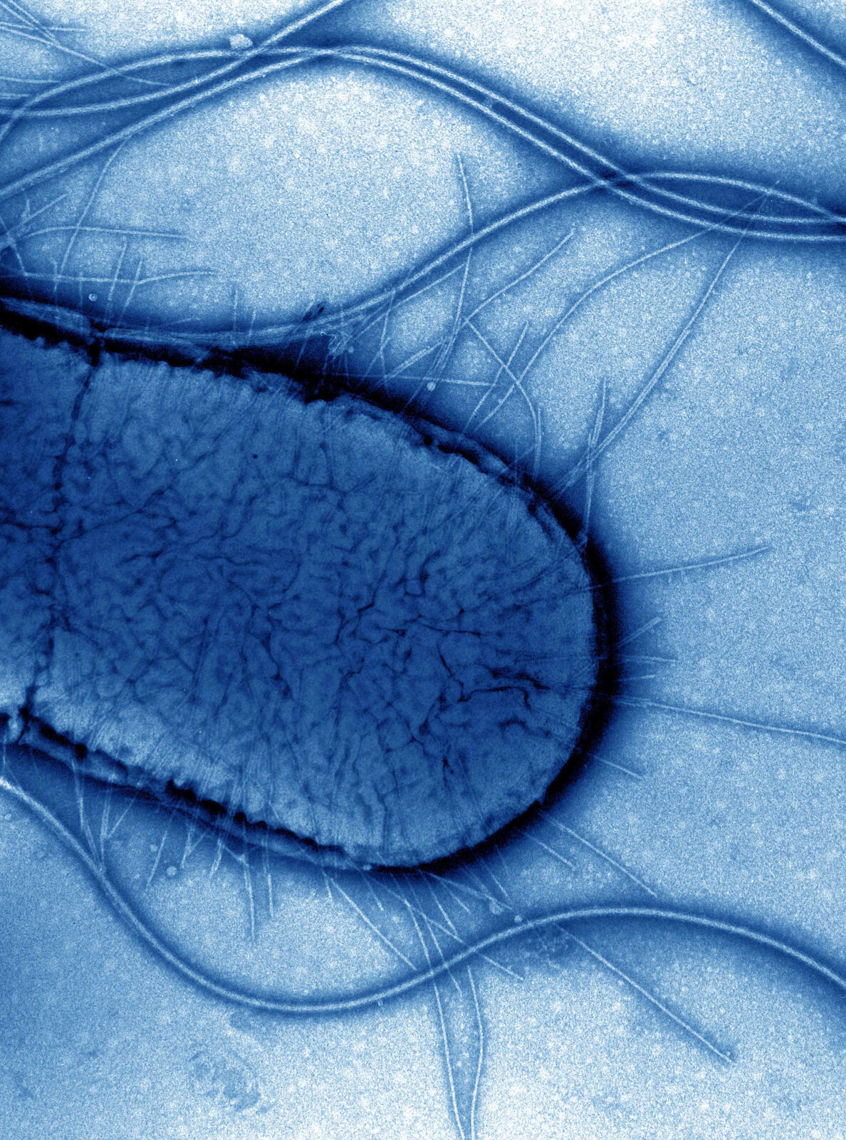Escherichia coli scanning electron micrograph