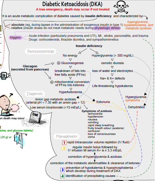 Diabetic ketoacidosis concept map showing ketoacid pathway