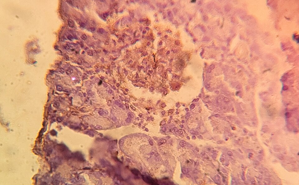 Pancreatic islet of Langerhans stained for insulin by immunohistochemistry