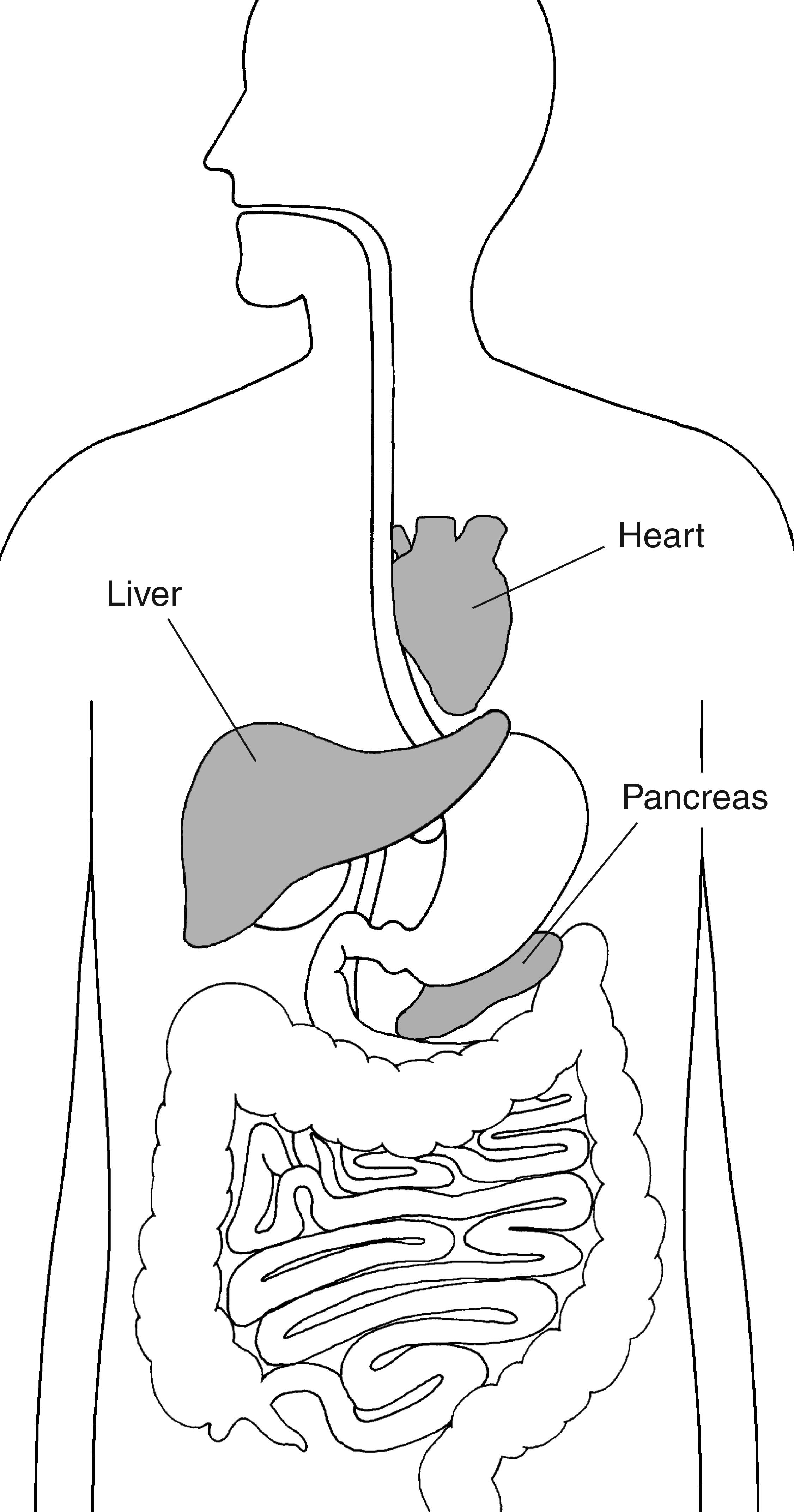 Systemic iron deposition links liver injury with pancreatic, cardiac, endocrine, skin, and joint disease