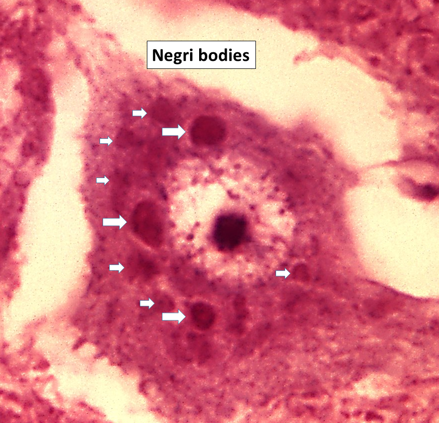 Negri bodies in Purkinje cells