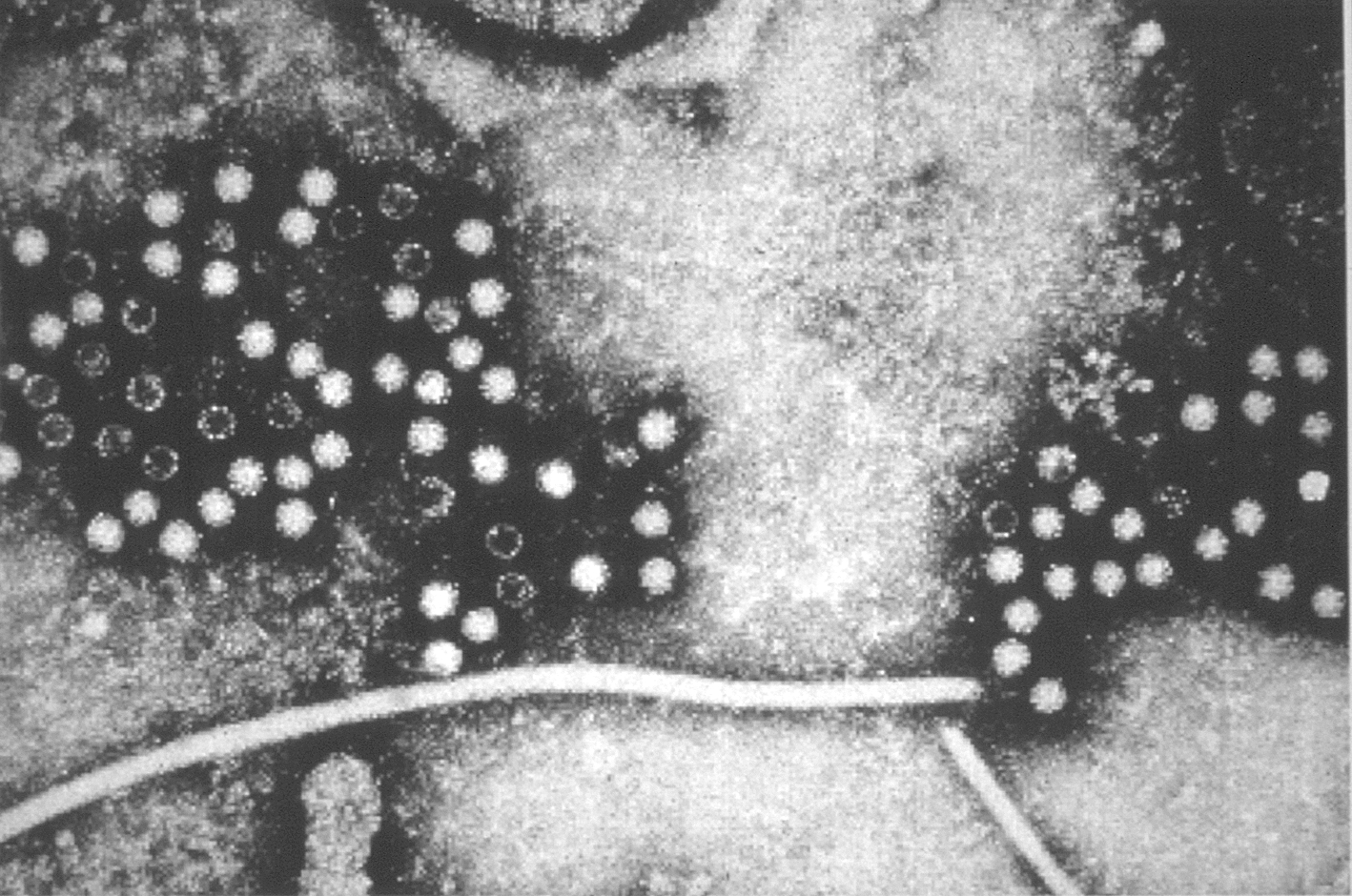 Hepatitis E virus EM