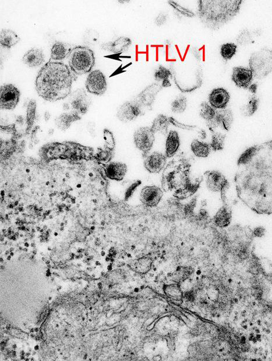 HTLV-1 EM