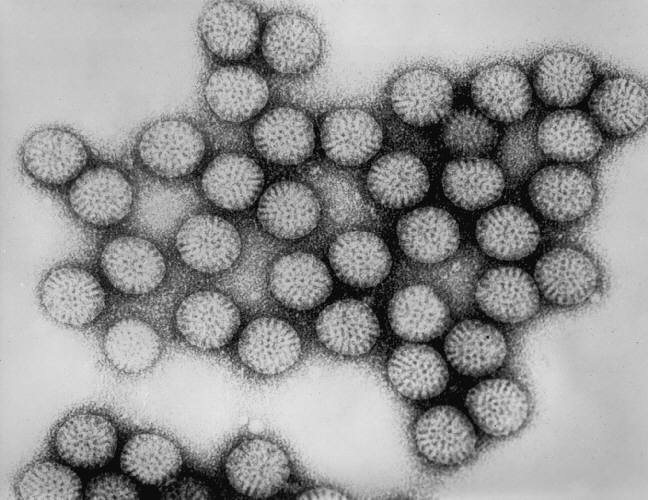 Rotavirus EM (wheel-shaped)