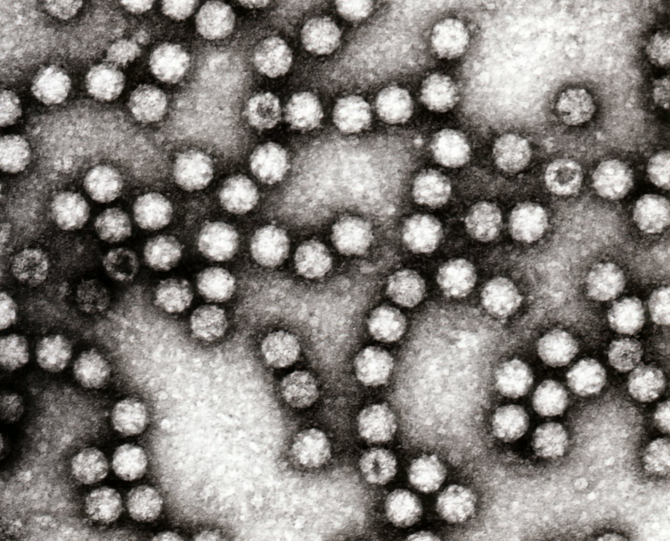 Astrovirus EM (star-shaped)