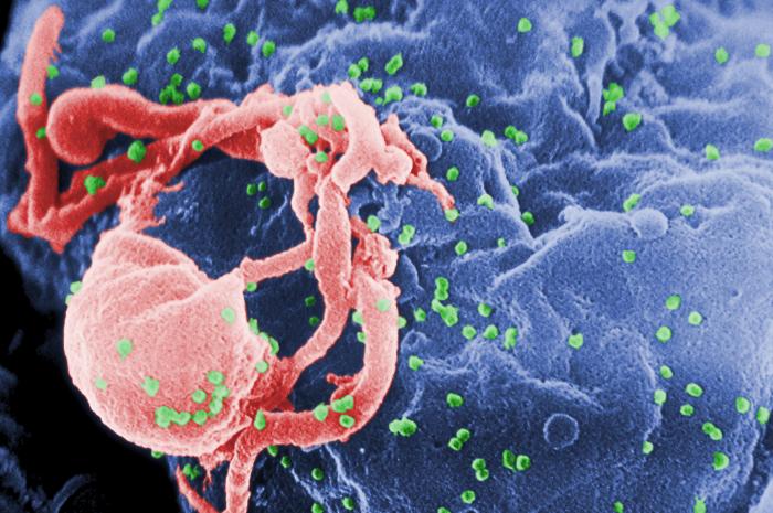 HIV budding from cell EM