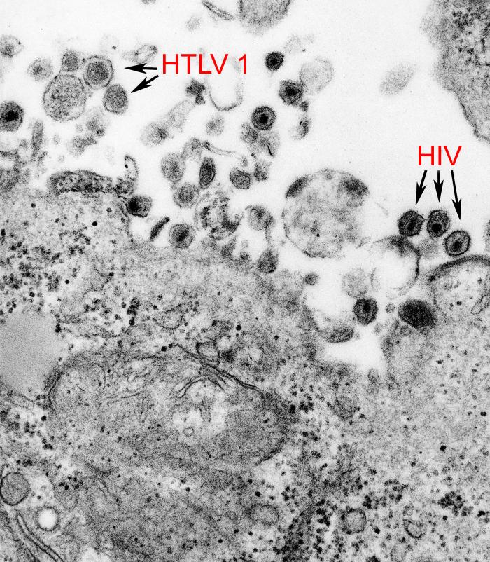 HTLV-1 and HIV-1 electron micrograph