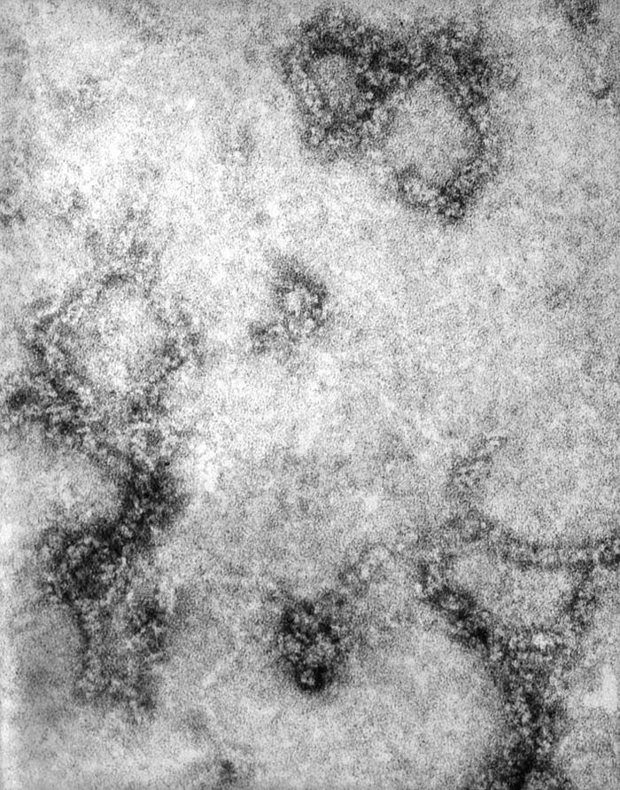 Poxvirus brick-shaped EM