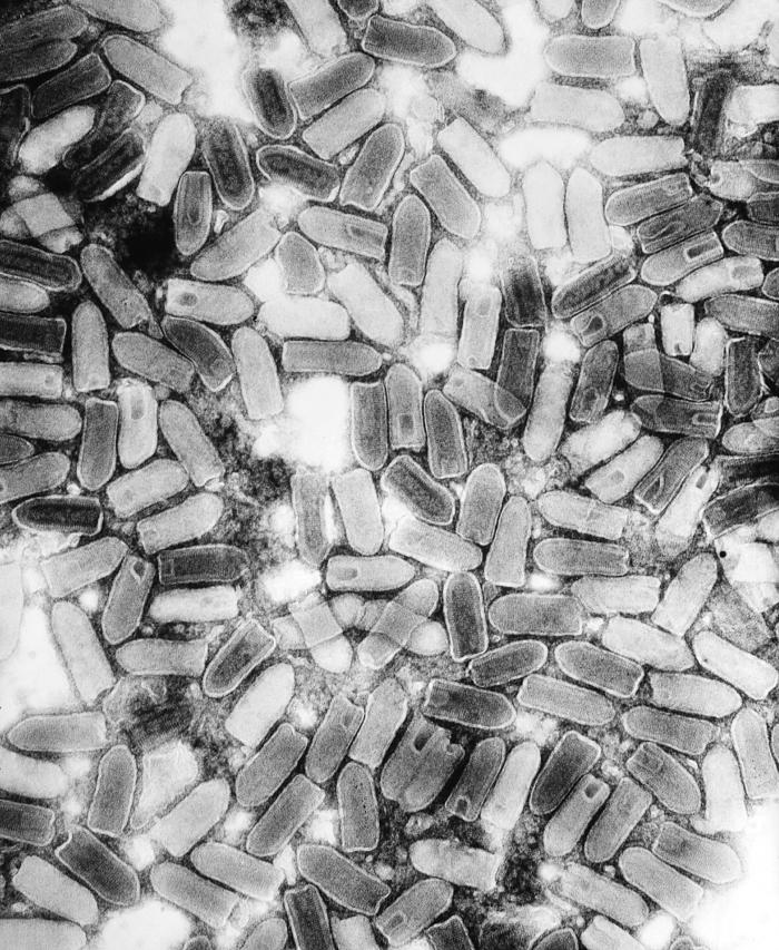 Rabies virus bullet-shaped EM