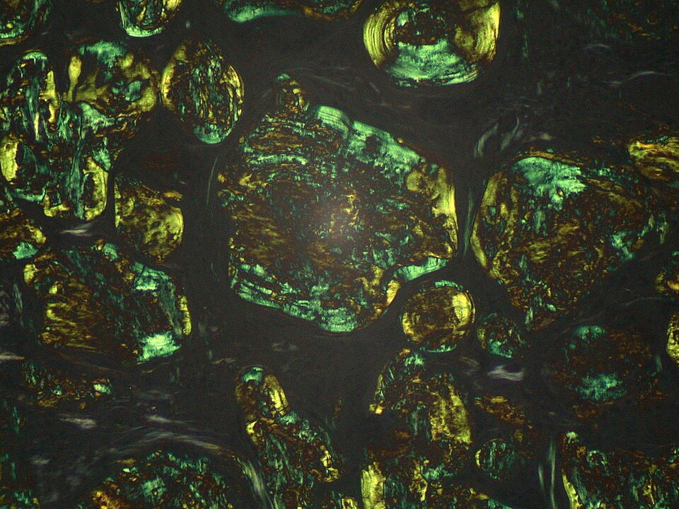 Apple-green birefringence on Congo red