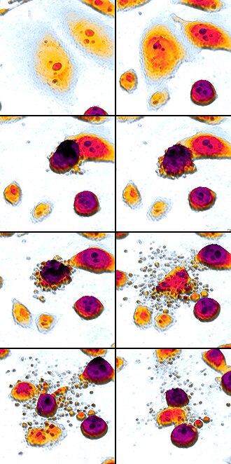Time-lapse mosaic of a cell undergoing apoptosis with membrane blebbing