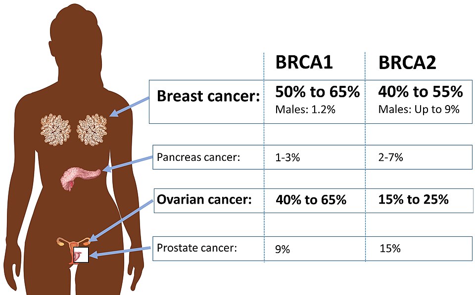 Chart of breast and ovarian cancer risk in BRCA1 and BRCA2 carriers