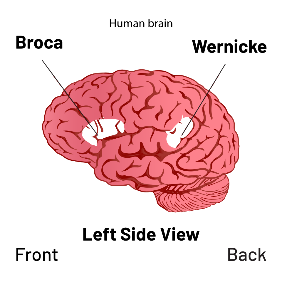Diagram of Broca area in inferior frontal gyrus and Wernicke area in superior temporal gyrus on the lateral cerebrum