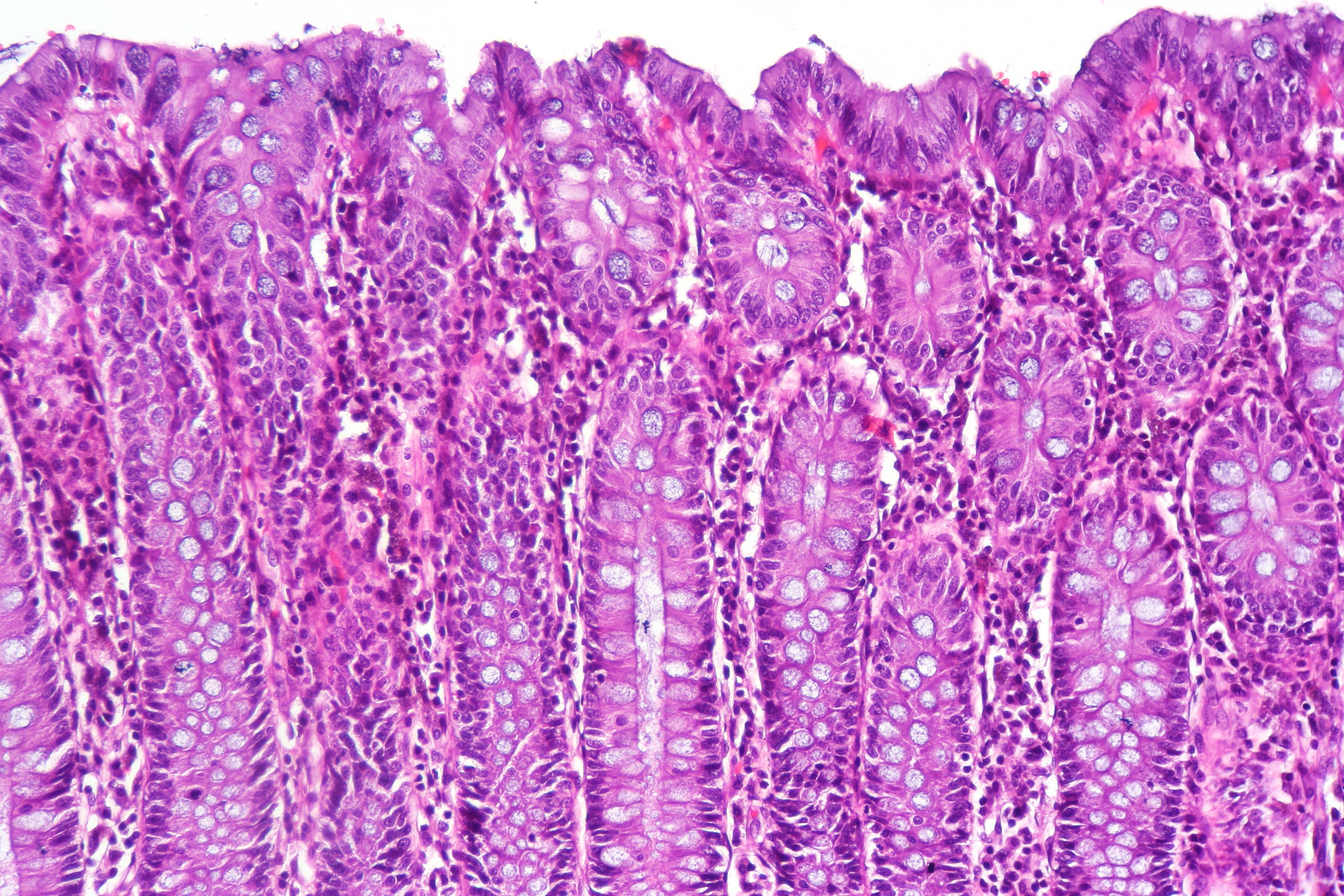 Normal colon histology high magnification