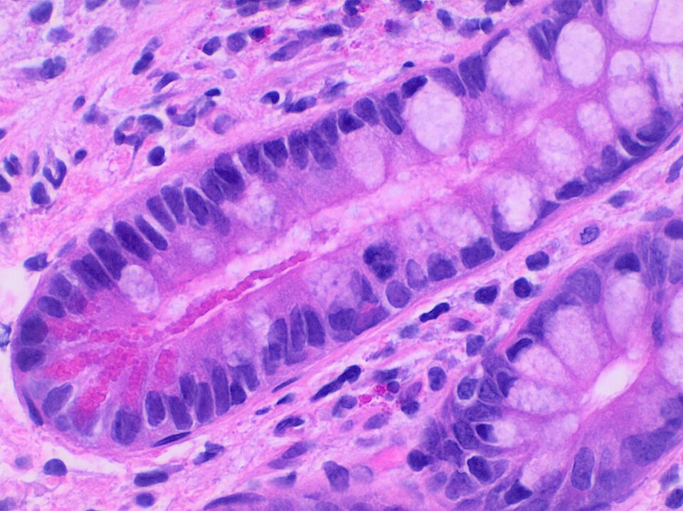 CC0 small-intestine mucosa histology showing crypt cells and Paneth cells