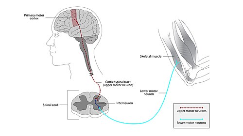 Upper and lower motor neuron pathway diagram
