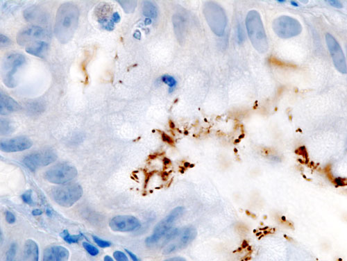 H pylori histology