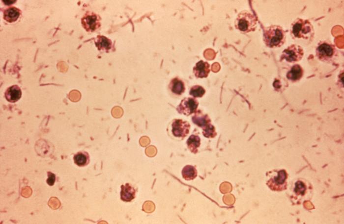 Shigella colonies on culture plate