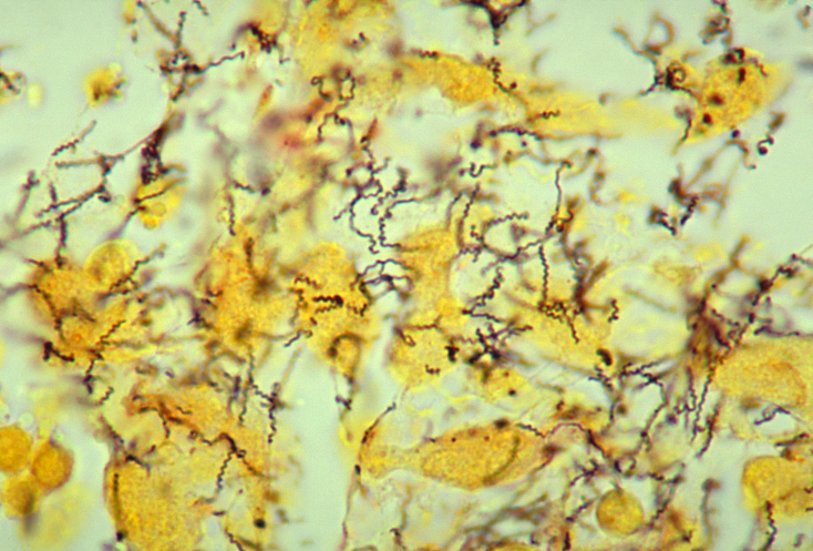 Treponema pallidum spirochete