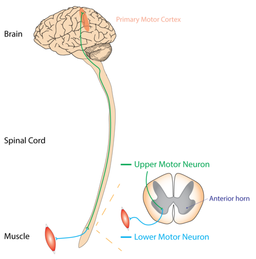 Upper motor neuron and lower motor neuron comparison diagram