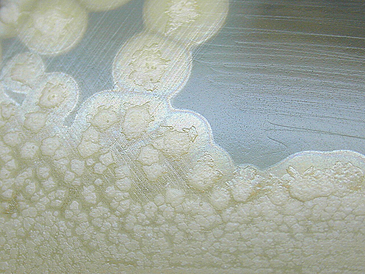 Clostridium botulinum colonies on culture medium