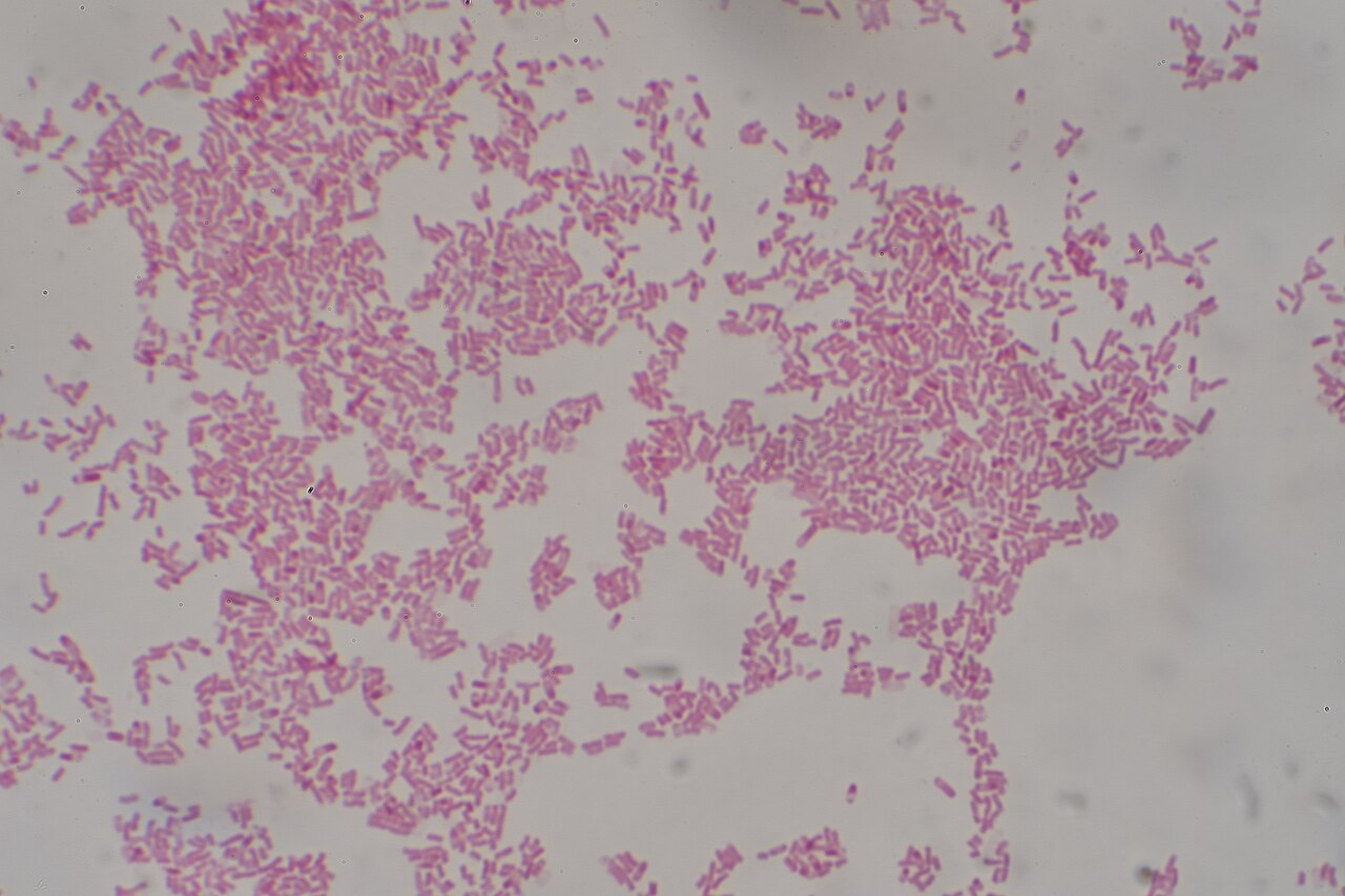 E. coli gram stain showing gram-negative rods