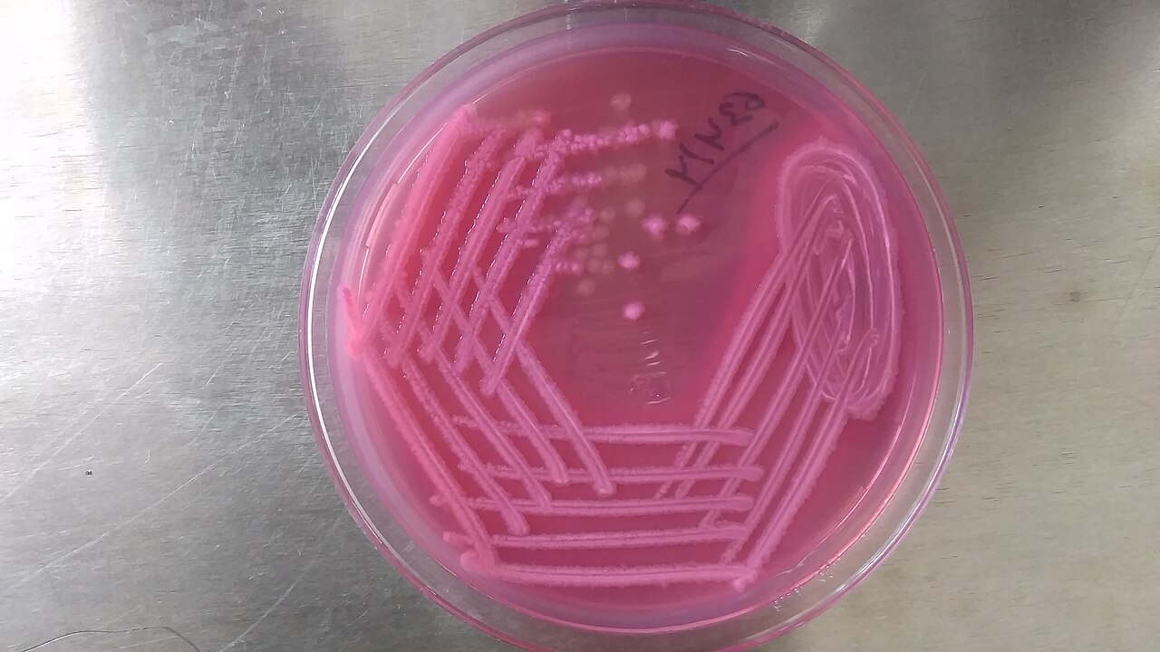 MacConkey agar with pink lactose-fermenting colonies (lactose-positive enteric)
