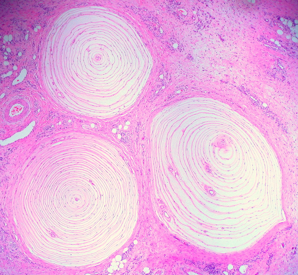 Pacinian corpuscle histology with onion-like lamellae