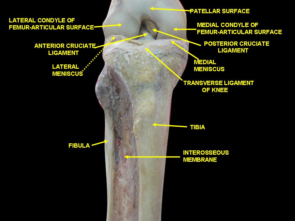Dissection labeling the interosseous membrane connecting the tibia and fibula