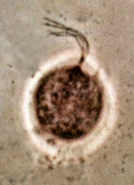 A pear-shaped trichomonad with fine projecting flagella in a phase-contrast micrograph.