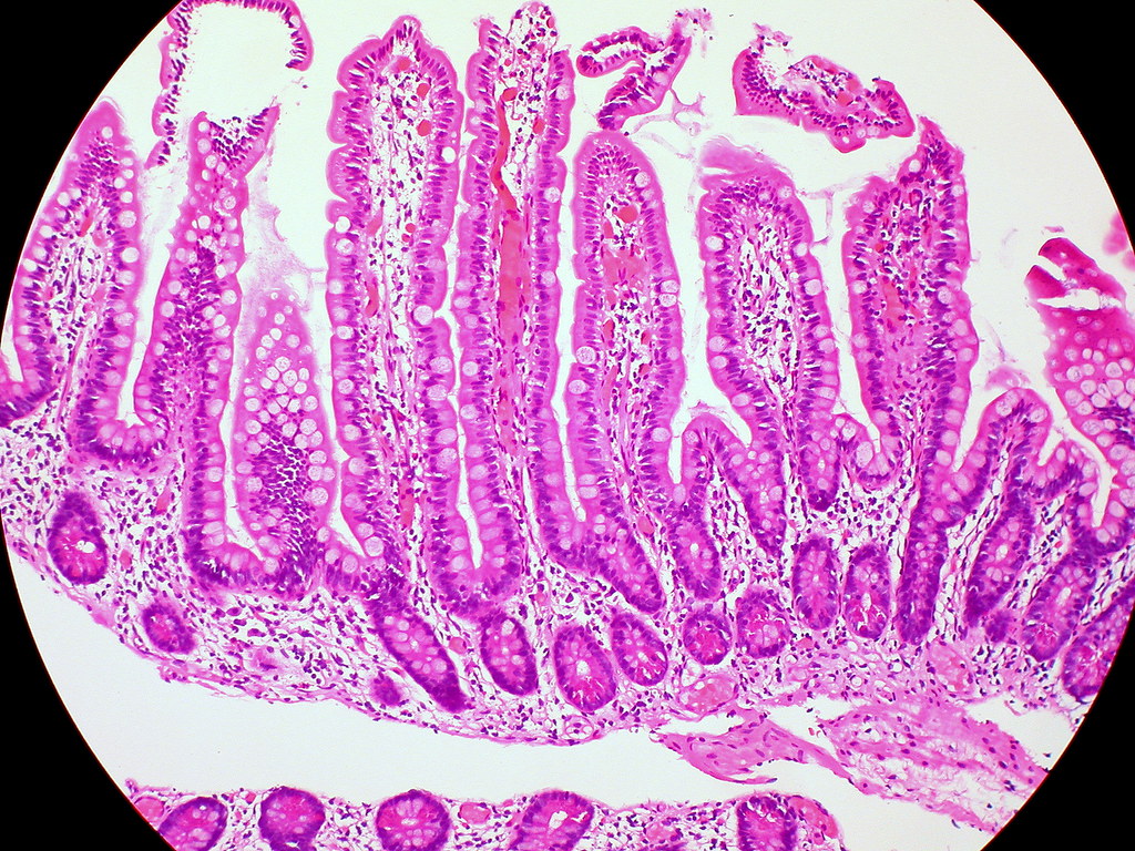 Human intestinal micrograph showing elongated villi, surface epithelial cells, pale goblet cells and crypt profiles.