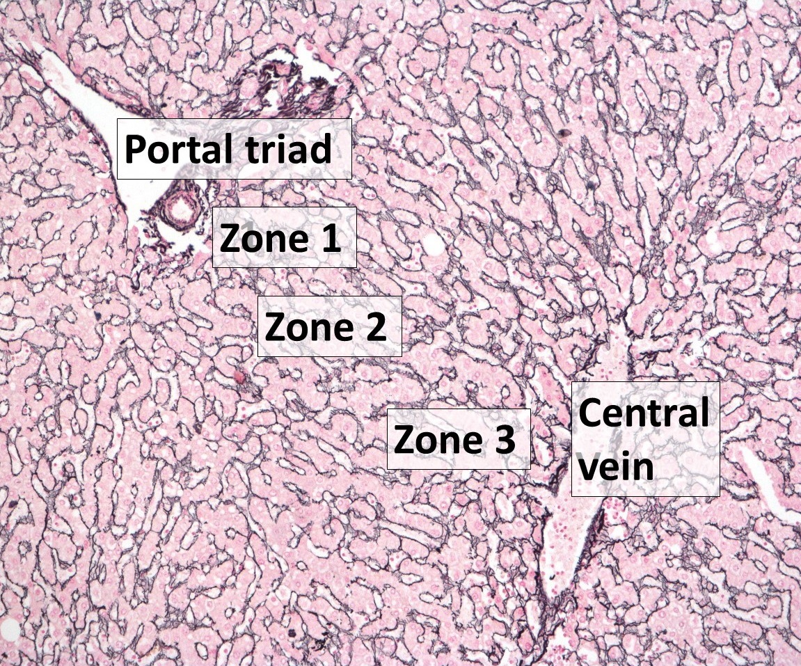 A reticulin-stained tissue section contains a portal triad toward the upper left and a central vein toward the lower right. Pre-existing labels identify periportal zone 1, intermediate zone 2 and pericentral zone 3 among branching hepatocyte plates.