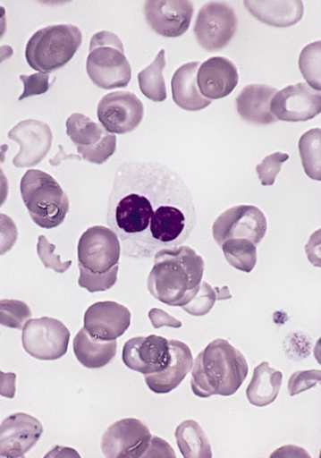 A neutrophil near the center has sparse cytoplasmic granules and two rounded nuclear lobes; surrounding red cells vary in shape.